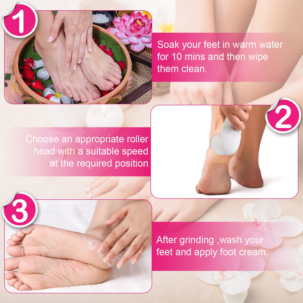 Electric Callus Remover with Vacuum, 17-Piece Kit